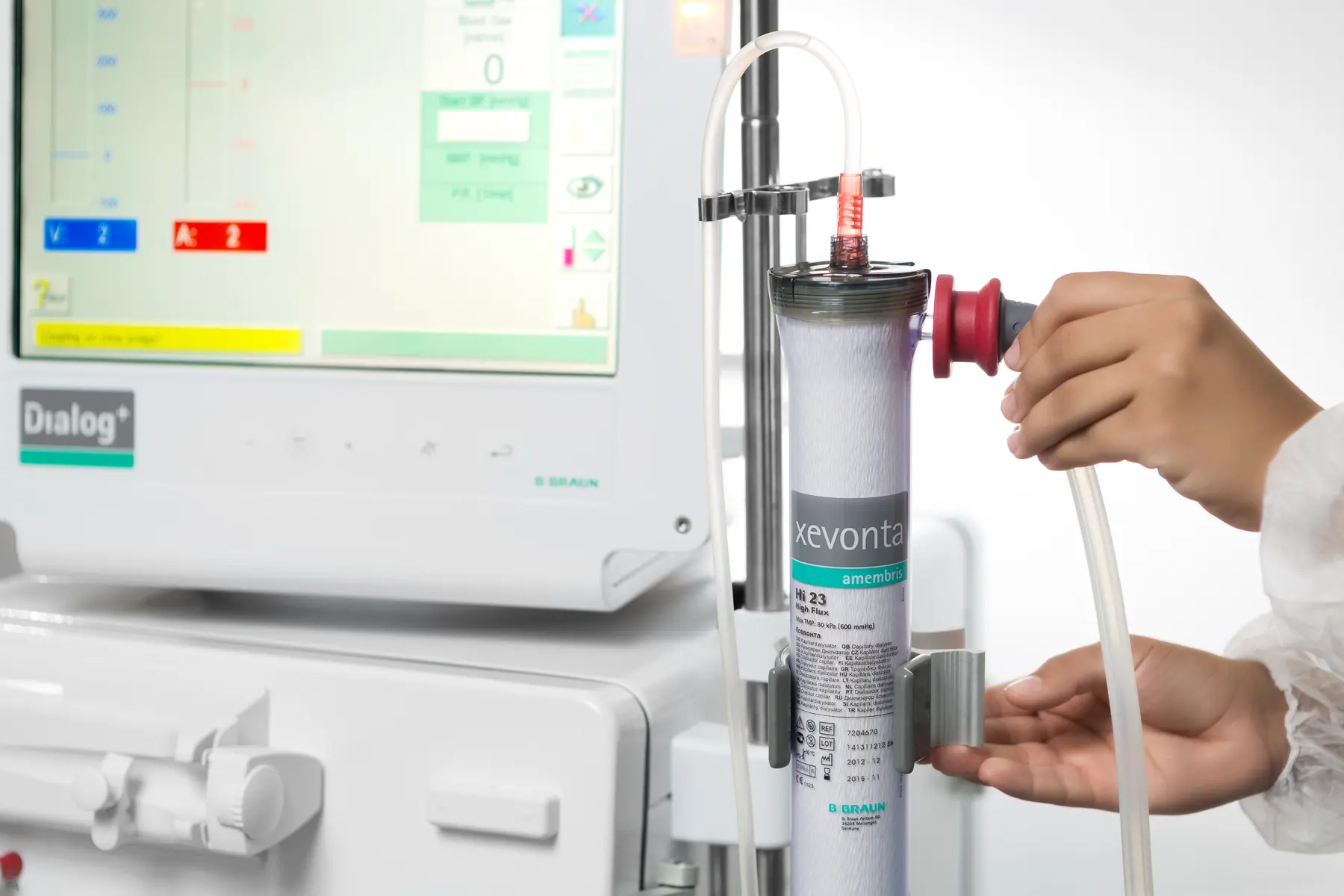 Equipamento de hemodiálise Xevonta conectado à máquina Dialog+ da B. Braun em ambiente clínico.